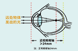 近视度数与眼轴增长关系